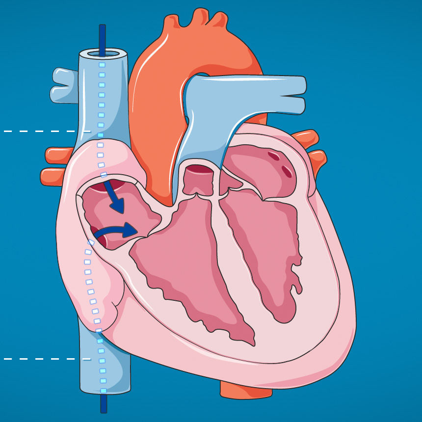 EMT Prep Cardiac Anatomy